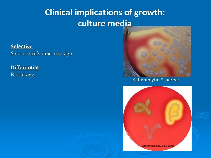 Clinical implications of growth: culture media Selective Sabouraud’s dextrose agar Differential Blood agar b-