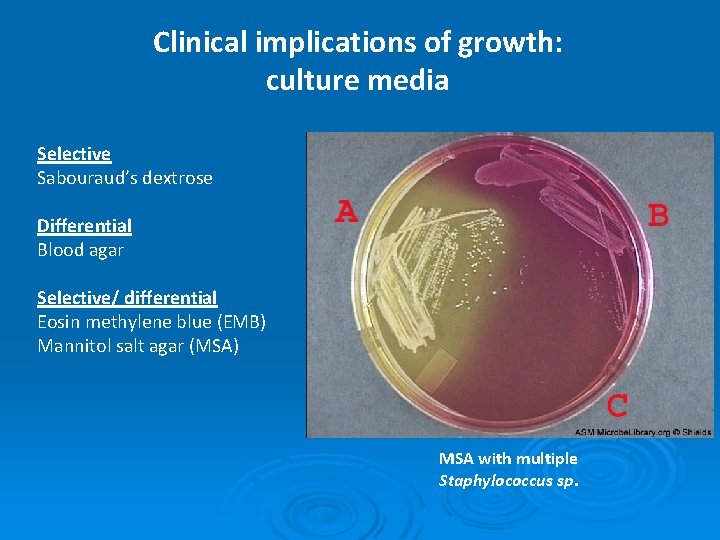 Clinical implications of growth: culture media Selective Sabouraud’s dextrose Differential Blood agar Selective/ differential