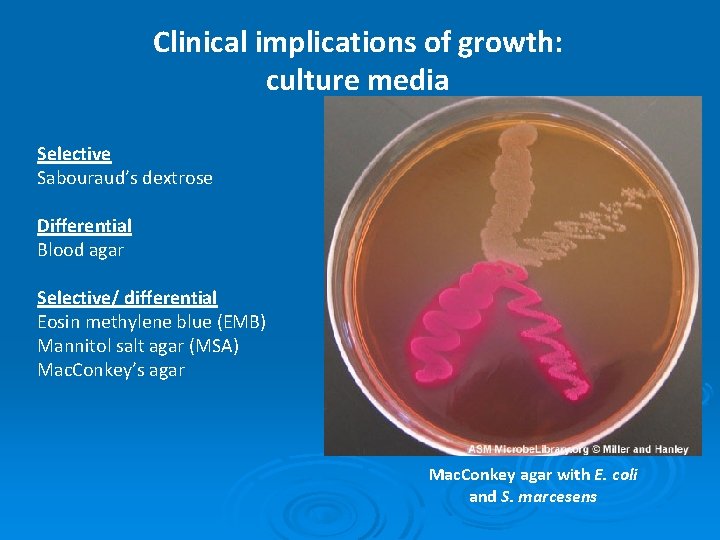 Clinical implications of growth: culture media Selective Sabouraud’s dextrose Differential Blood agar Selective/ differential