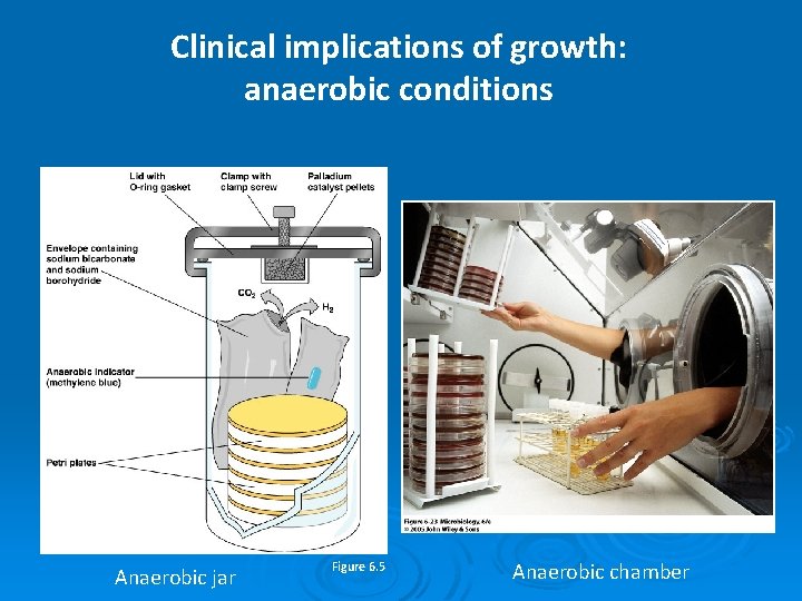 Clinical implications of growth: anaerobic conditions Anaerobic jar Figure 6. 5 Anaerobic chamber 