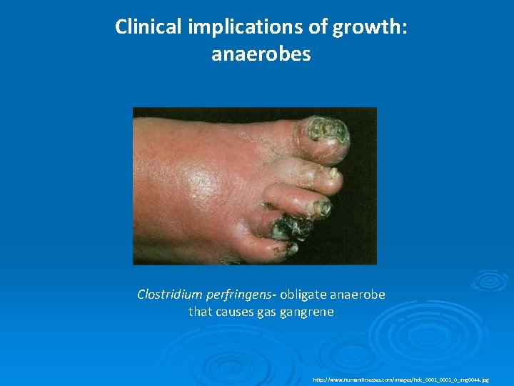Clinical implications of growth: anaerobes Clostridium perfringens- obligate anaerobe that causes gangrene http: //www.