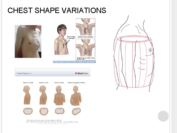 CHEST SHAPE VARIATIONS 