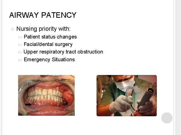 AIRWAY PATENCY Nursing priority with: Patient status changes Facial/dental surgery Upper respiratory tract obstruction