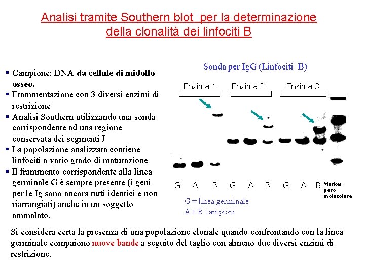 Analisi tramite Southern blot per la determinazione della clonalità dei linfociti B § Campione: