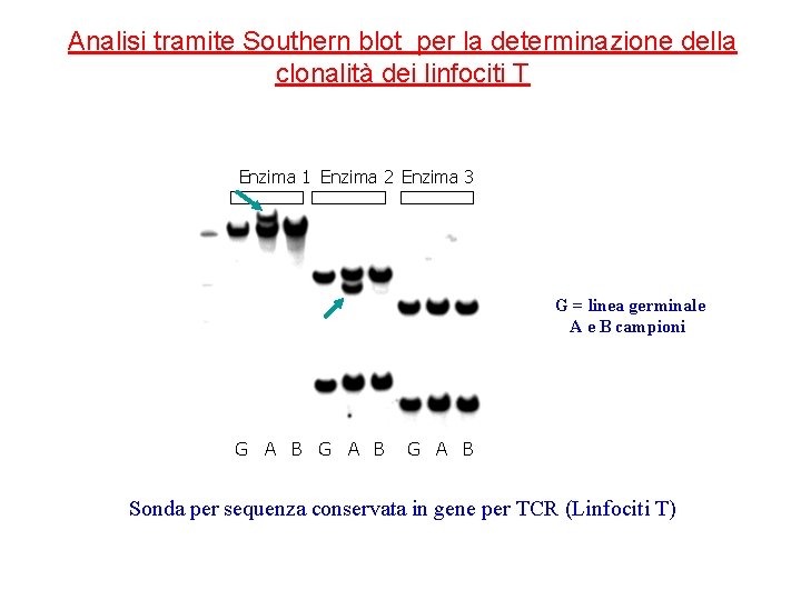 Analisi tramite Southern blot per la determinazione della clonalità dei linfociti T Enzima 1