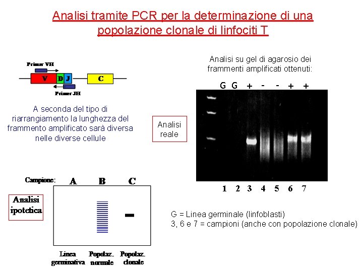 Analisi tramite PCR per la determinazione di una popolazione clonale di linfociti T Analisi
