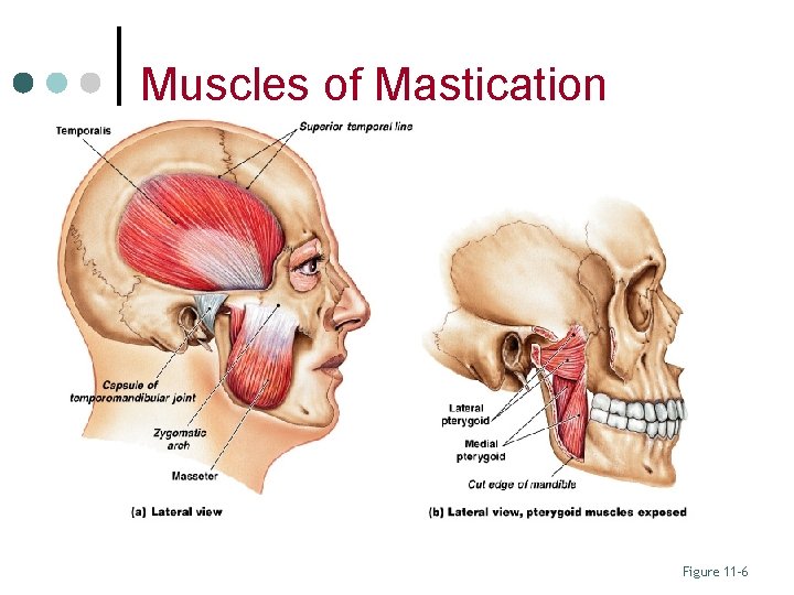 Muscles of Mastication Figure 11– 6 