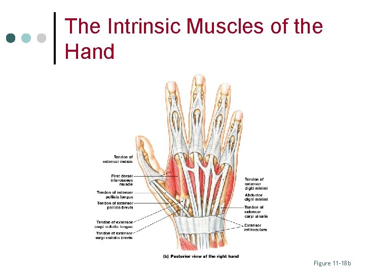 The Intrinsic Muscles of the Hand Figure 11– 18 b 