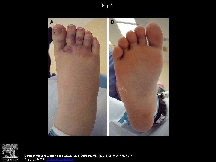 Fig. 1 Clinics in Podiatric Medicine and Surgery 2011 2869 -86 DOI: (10. 1016/j.