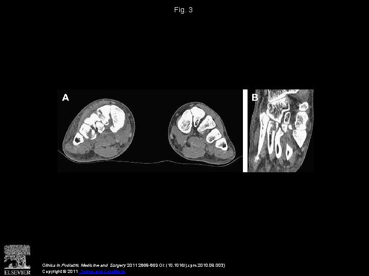 Fig. 3 Clinics in Podiatric Medicine and Surgery 2011 2869 -86 DOI: (10. 1016/j.