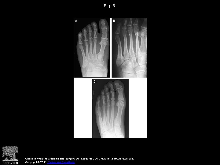 Fig. 5 Clinics in Podiatric Medicine and Surgery 2011 2869 -86 DOI: (10. 1016/j.