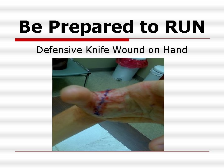 Be Prepared to RUN Defensive Knife Wound on Hand 
