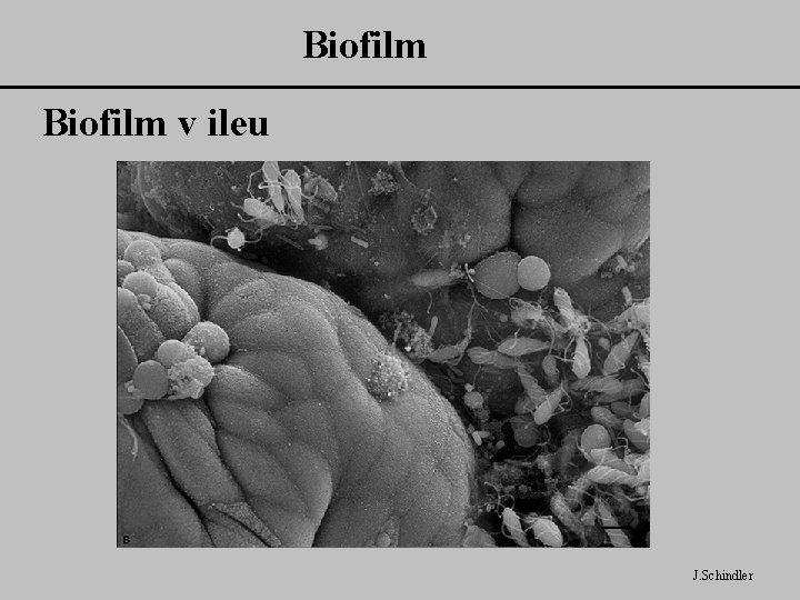 Biofilm v ileu J. Schindler 