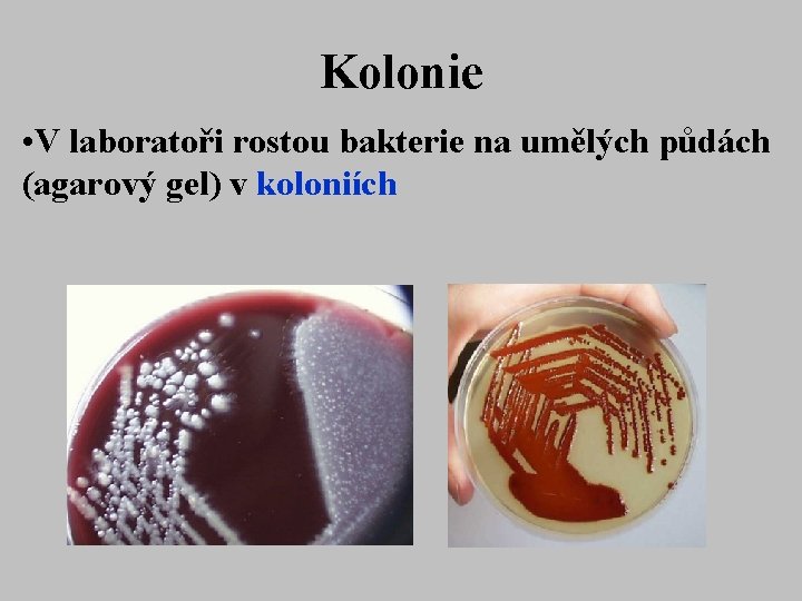 Kolonie • V laboratoři rostou bakterie na umělých půdách (agarový gel) v koloniích 
