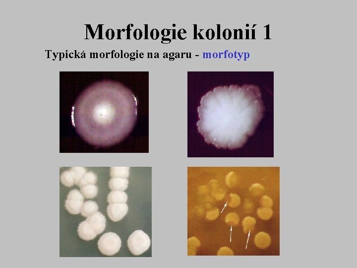 Morfologie kolonií 1 Typická morfologie na agaru - morfotyp 