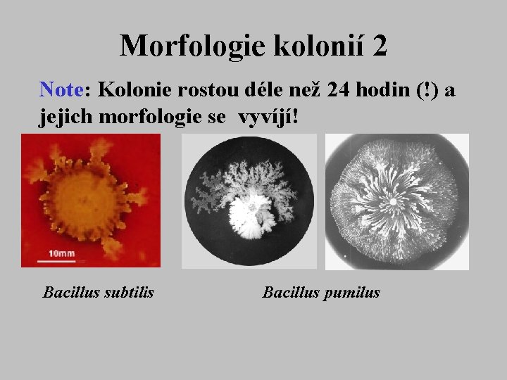 Morfologie kolonií 2 Note: Kolonie rostou déle než 24 hodin (!) a jejich morfologie