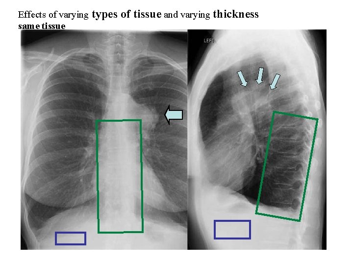 Effects of varying types same tissue of tissue and varying thickness www. med. harvard.