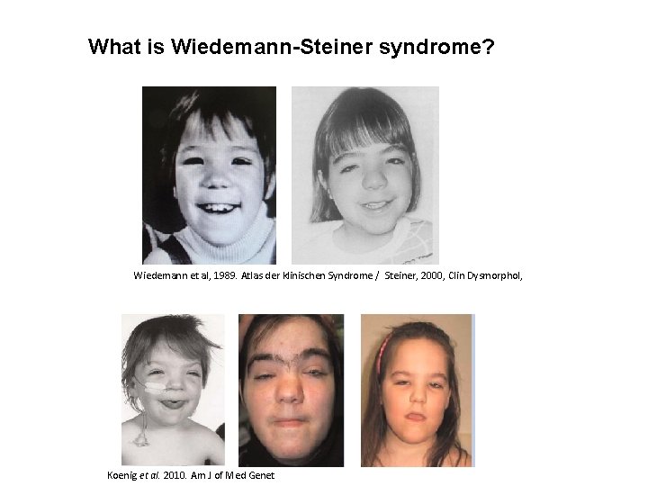 What is Wiedemann-Steiner syndrome? Wiedemann et al, 1989. Atlas der klinischen Syndrome / Steiner,