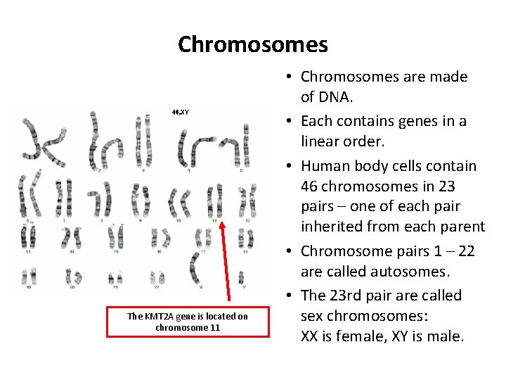 Chromosomes The KMT 2 A gene is located on chromosome 11 • Chromosomes are
