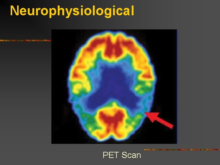Neurophysiological PET Scan 