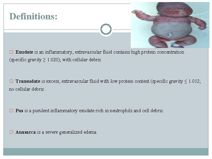 Definitions: � Exudate is an inflammatory, extravascular fluid contains high protein concentration (specific gravity