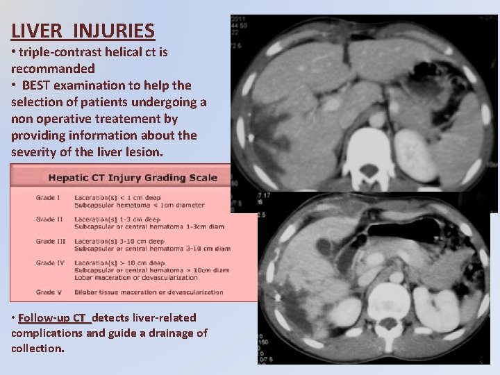 LIVER INJURIES • triple-contrast helical ct is recommanded • BEST examination to help the