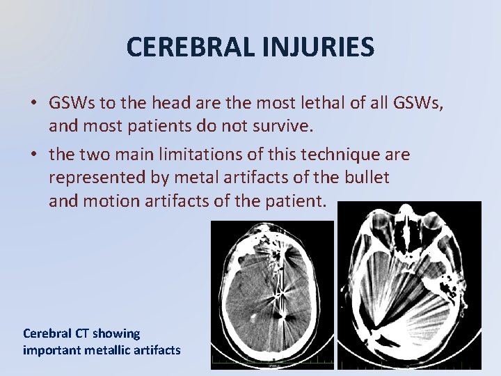 CEREBRAL INJURIES • GSWs to the head are the most lethal of all GSWs,