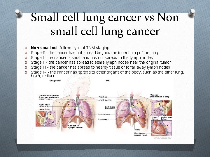 Small cell lung cancer vs Non small cell lung cancer O O O Non-small