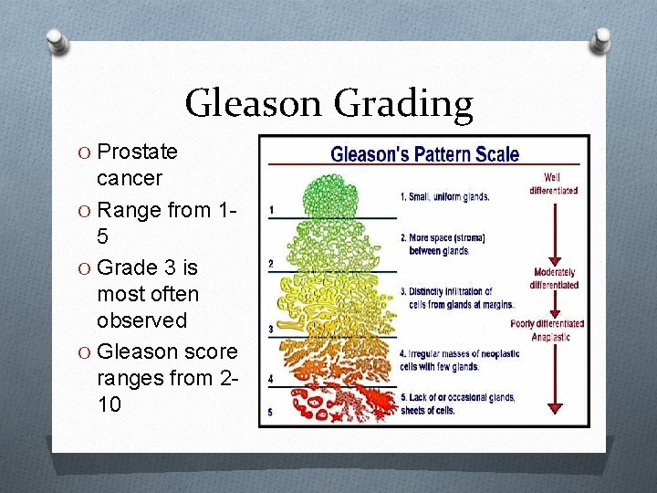 Gleason Grading O Prostate cancer O Range from 15 O Grade 3 is most