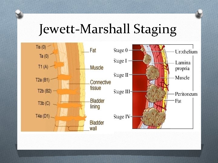 Jewett-Marshall Staging 