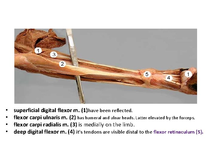  • • superficial digital flexor m. (1)have been reflected. flexor carpi ulnaris m.