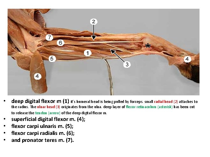  • deep digital flexor m (1) it’s humeral head is being pulled by