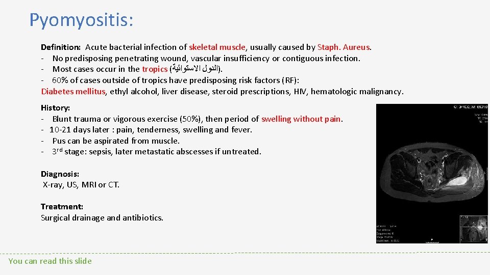 Pyomyositis: Definition: Acute bacterial infection of skeletal muscle, usually caused by Staph. Aureus. -
