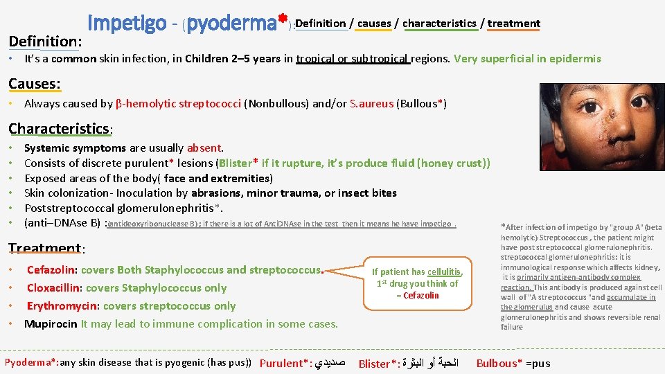 Definition: Impetigo - (pyoderma*): Definition / causes / characteristics / treatment • It’s a