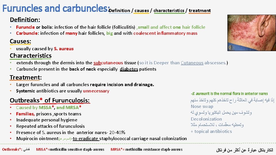 Furuncles and carbuncles: Definition / causes / characteristics / treatment Definition: • Furuncle or