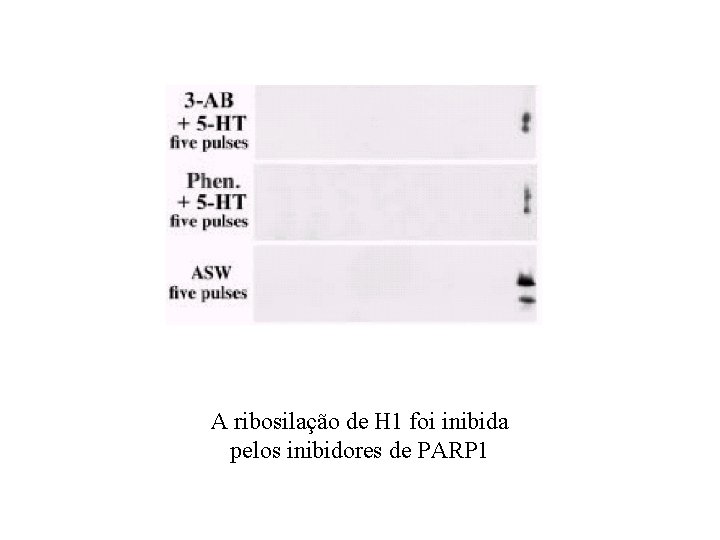 A ribosilação de H 1 foi inibida pelos inibidores de PARP 1 