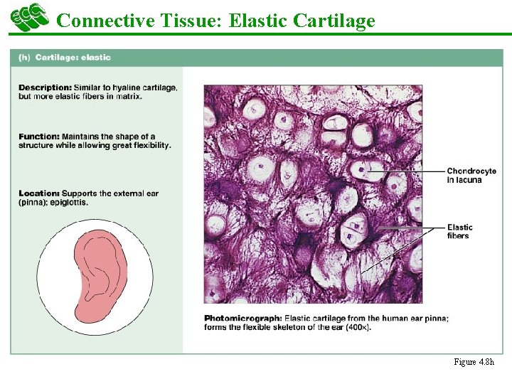 Connective Tissue: Elastic Cartilage § Similar to hyaline cartilage but with more elastic fibers