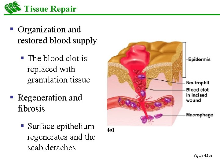 Tissue Repair § Organization and restored blood supply § The blood clot is replaced