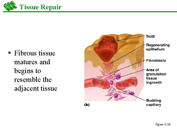 Tissue Repair § Fibrous tissue matures and begins to resemble the adjacent tissue Figure