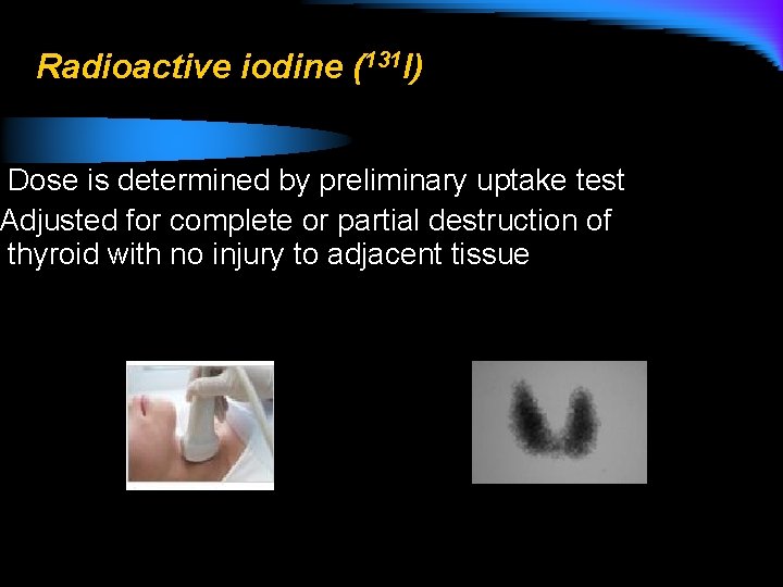 Radioactive iodine (131 I) Dose is determined by preliminary uptake test Adjusted for complete