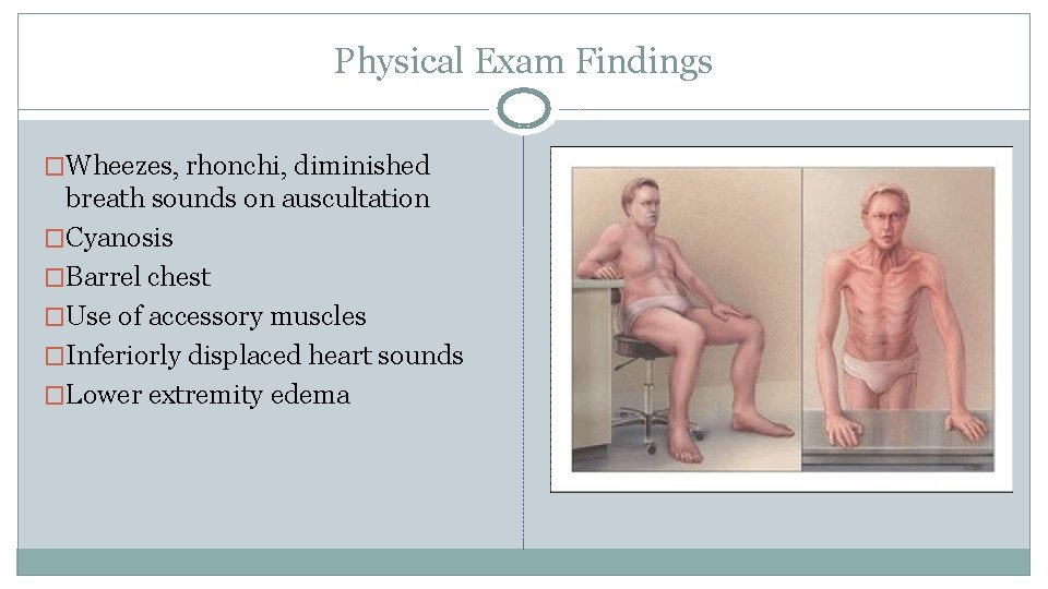 Physical Exam Findings �Wheezes, rhonchi, diminished breath sounds on auscultation �Cyanosis �Barrel chest �Use