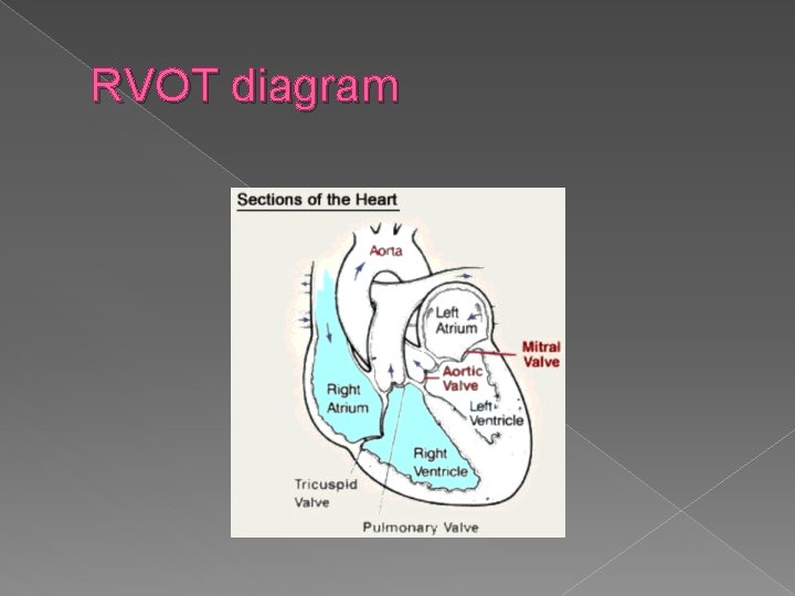 RVOT diagram 