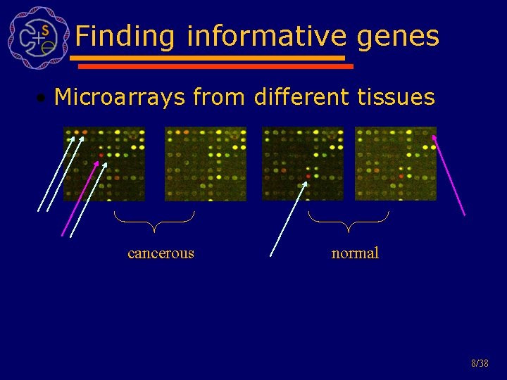 Finding informative genes • Microarrays from different tissues cancerous normal 8/38 