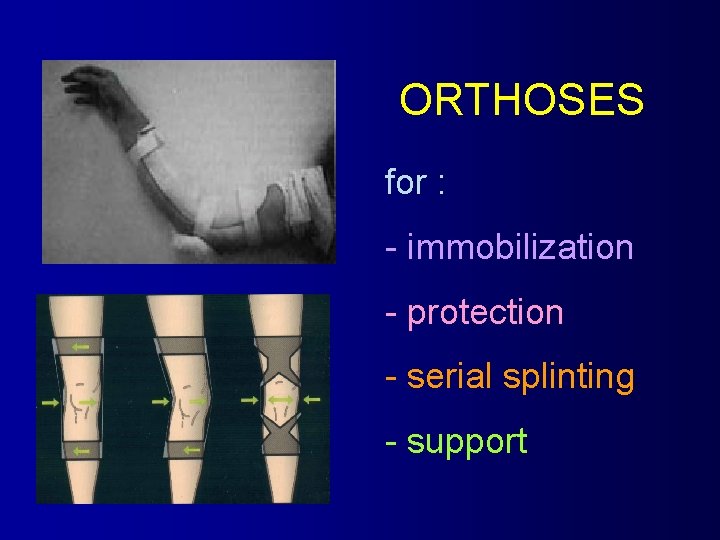 ORTHOSES for : - immobilization - protection - serial splinting - support 