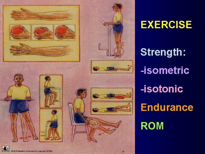 EXERCISE Strength: -isometric -isotonic Endurance ROM 