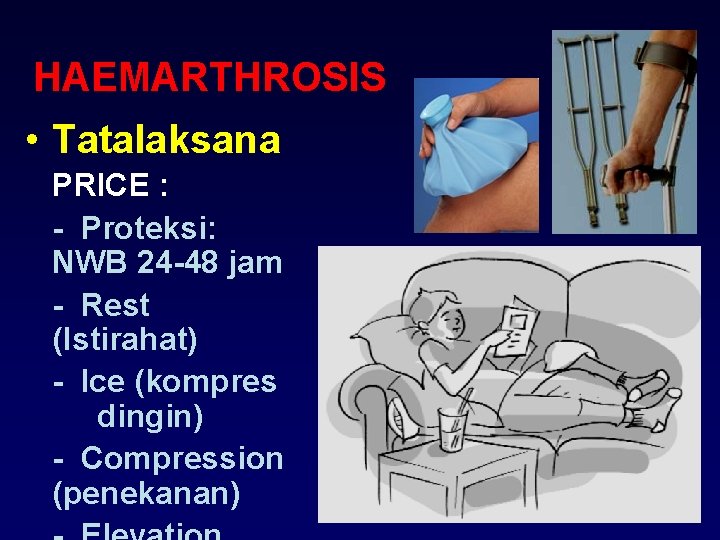 HAEMARTHROSIS • Tatalaksana PRICE : - Proteksi: NWB 24 -48 jam - Rest (Istirahat)