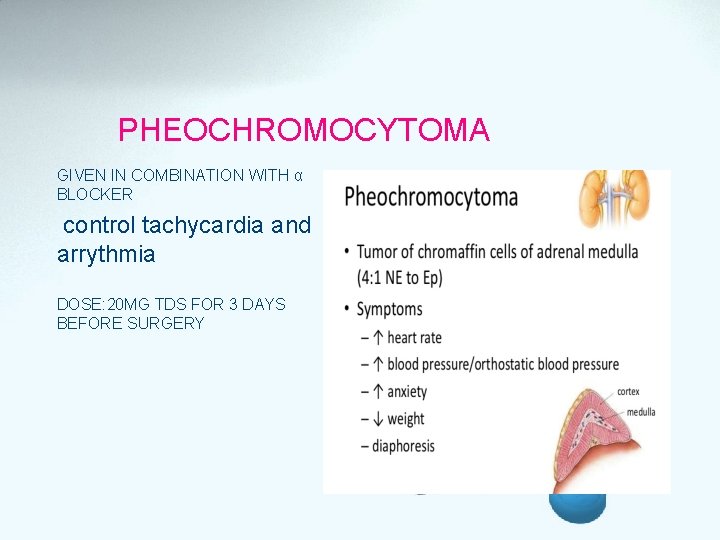 PHEOCHROMOCYTOMA GIVEN IN COMBINATION WITH α BLOCKER control tachycardia and arrythmia DOSE: 20 MG