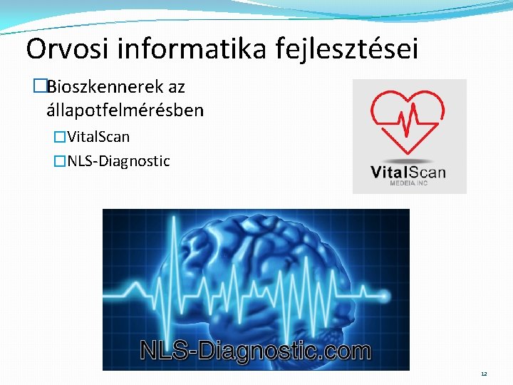 Orvosi informatika fejlesztései �Bioszkennerek az állapotfelmérésben �Vital. Scan �NLS-Diagnostic 12 