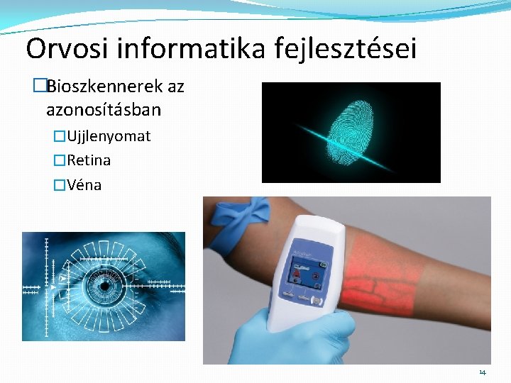 Orvosi informatika fejlesztései �Bioszkennerek az azonosításban �Ujjlenyomat �Retina �Véna 14 