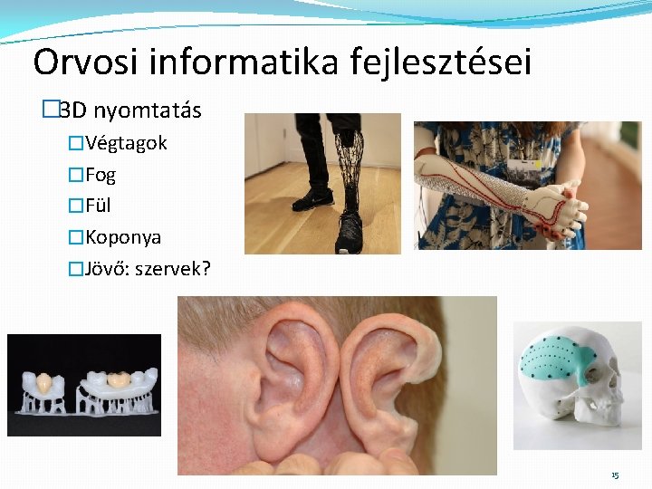 Orvosi informatika fejlesztései � 3 D nyomtatás �Végtagok �Fog �Fül �Koponya �Jövő: szervek? 15